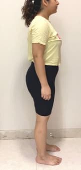 Client Story after