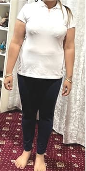 Client Story after