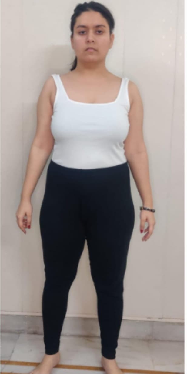 Client Story before