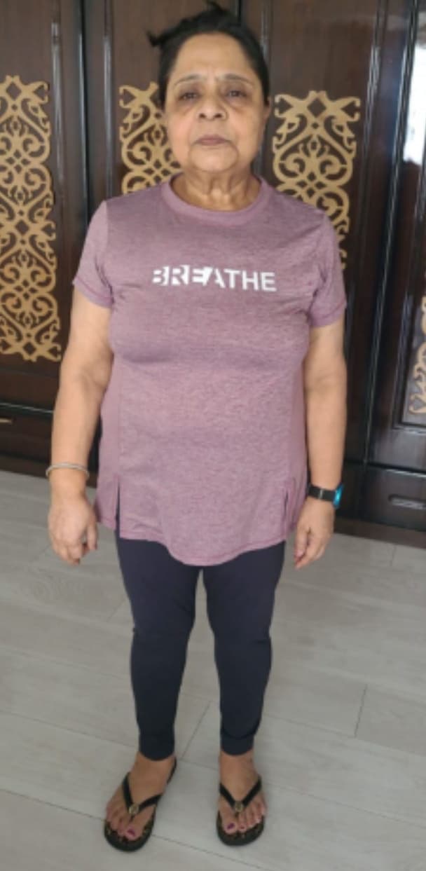 Client Story before