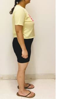 Client Story before