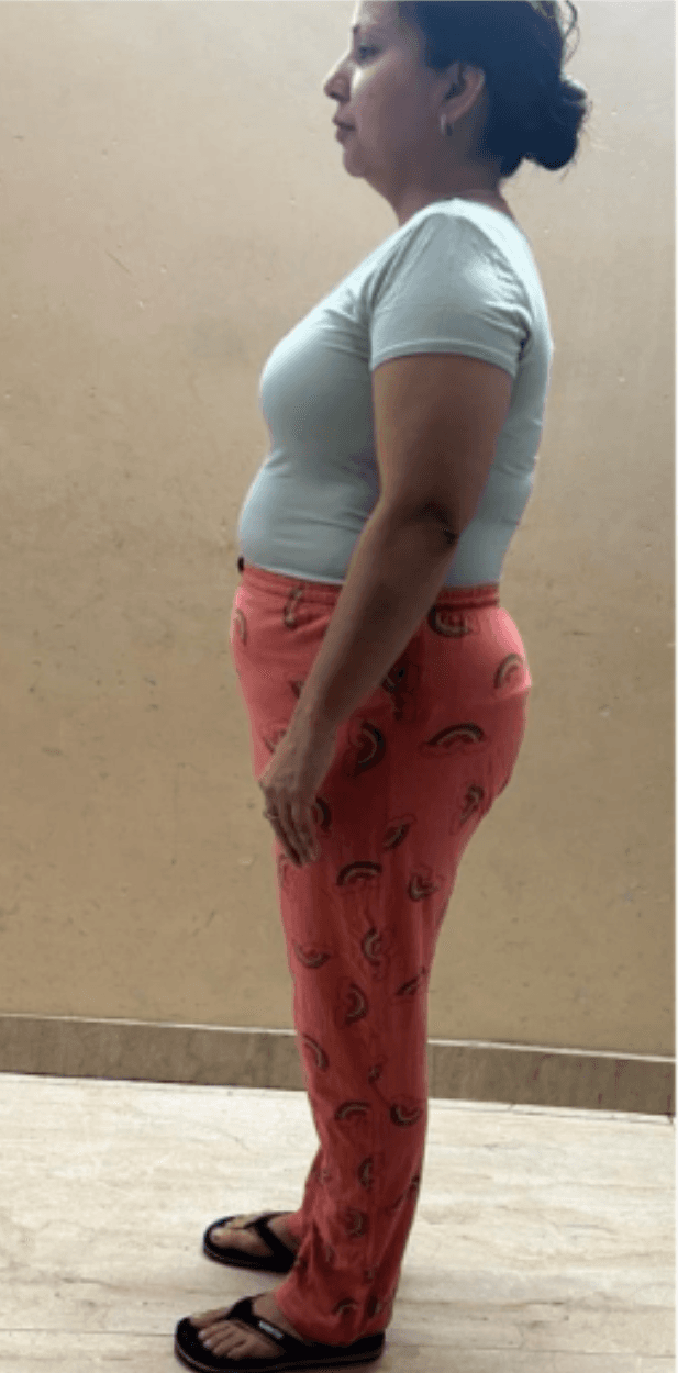 Client Story before